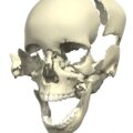 disarticulated-skull-medical-images-universal-images-group